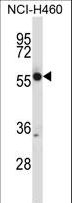 CRMP1 Antibody - CRMP1 Antibody western blot of NCI-H460 cell line lysates (35 ug/lane). The CRMP1 antibody detected the CRMP1 protein (arrow).