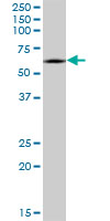 CRMP1 Antibody - CRMP1 monoclonal antibody (M50), clone 2B6. Western Blot analysis of CRMP1 expression in IMR-32.