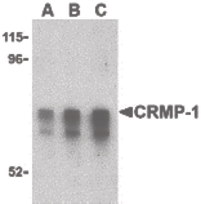 CRMP1 Antibody - Western blot of CRMP1 in Caco-2 cell lysate with CRMP1 antibody at (A) 1, (B) 2 and (C) 4 ug/ml.