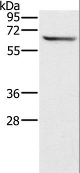 CRMP1 Antibody - Western blot analysis of Mouse brain tissue, using CRMP1 Polyclonal Antibody at dilution of 1:500.