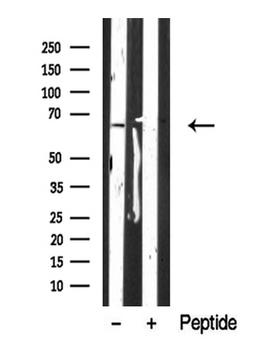 CRMP1 Antibody - Western blot analysis of extracts of rat brain tissue sample using CRMP-1 antibody.