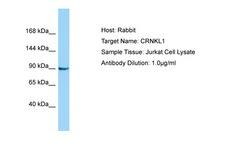 CRNKL1 Antibody -  This image was taken for the unconjugated form of this product. Other forms have not been tested.