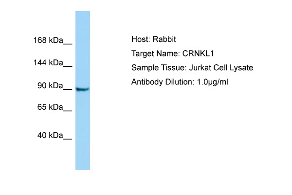 CRNKL1 Antibody -  This image was taken for the unconjugated form of this product. Other forms have not been tested.