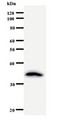 CRNKL1 Antibody - Western blot of immunized recombinant protein using CRNKL1 antibody.