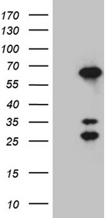 CRNN / Cornulin Antibody - HEK293T cells were transfected with the pCMV6-ENTRY control. (Left lane) or pCMV6-ENTRY CRNN. (Right lane) cDNA for 48 hrs and lysed