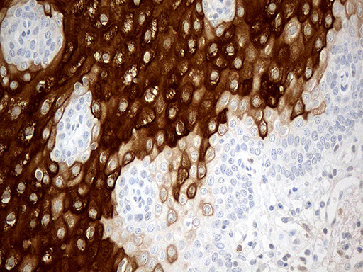 CRNN / Cornulin Antibody - Immunohistochemical staining of paraffin-embedded Human esophagus within the normal limits using anti-CRNN mouse monoclonal antibody. (Heat-induced epitope retrieval by 1mM EDTA in 10mM Tris buffer. (pH8.5) at 120°C for 3 min. (1:500)