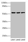 CRNN / Cornulin Antibody - Western blot All lanes: CRNN antibody at 12µg/ml Lane 1: HepG2 whole cell lysate Lane 2: Mouse heart tissue Lane 3: Rat skeletal muscle tissue Secondary Goat polyclonal to rabbit IgG at 1/10000 dilution Predicted band size: 54 kDa Observed band size: 54 kDa
