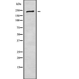 CROCC / Rootletin Antibody - Western blot analysis of CROCC using COLO205 whole cells lysates