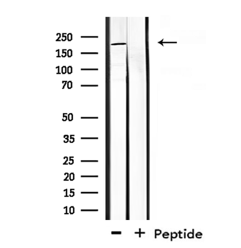CROCC / Rootletin Antibody - Western blot analysis of extracts of mouse brain tissue using CROCC antibody.