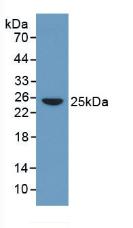 CRP / C-Reactive Protein Antibody - Western Blot; Sample: Human Serum.