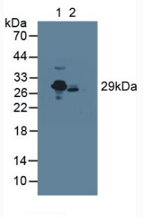 CRP / C-Reactive Protein Antibody - Western Blot; Sample: Lane1: Rat Serum; Lane2: Mouse Serum.