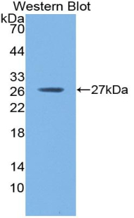 CRP / C-Reactive Protein Antibody - Western blot of recombinant CRP / C-Reactive Protein.  This image was taken for the unconjugated form of this product. Other forms have not been tested.