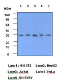 CRP / C-Reactive Protein Antibody - Cell lysates of NIH-3T3, HepG2, Jurkat, HeLa and SH-SY5Y (each 40 ug) were resolved by SDS-PAGE, transferred to PVDF membrane and probed with anti-human CRP (1:1000). Proteins were visualized using a goat anti-mouse secondary antibody conjugated to HRP and an ECL detection system. Lane 1: NIH-3T3; Lane 2: HepG2; Lane 3: Jurkat; Lane 4: HeLa; Lane 5: SH-SY5Y.
