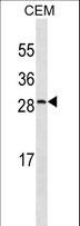 CRP / C-Reactive Protein Antibody - CRP Antibody western blot of CEM cell line lysates (35 ug/lane). The CRP antibody detected the CRP protein (arrow).