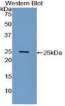 CRP / C-Reactive Protein Antibody - Western blot of recombinant CRP / C-Reactive Protein.  This image was taken for the unconjugated form of this product. Other forms have not been tested.