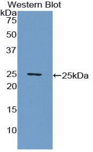 CRP / C-Reactive Protein Antibody - Western blot of recombinant CRP / C-Reactive Protein.  This image was taken for the unconjugated form of this product. Other forms have not been tested.