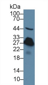 CRP / C-Reactive Protein Antibody - Western Blot; Sample: Rat Serum; Primary Ab: 3µg/ml Rabbit Anti-Rat CRP Antibody Second Ab: 0.2µg/mL HRP-Linked Caprine Anti-Rabbit IgG Polyclonal Antibody (Catalog: SAA544Rb19