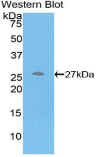 CRP / C-Reactive Protein Antibody - Western blot of recombinant CRP / C-Reactive Protein.  This image was taken for the unconjugated form of this product. Other forms have not been tested.