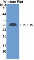 CRP / C-Reactive Protein Antibody - WesternBlot;Sample:RecombinantCRP,Rat.