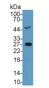 CRP / C-Reactive Protein Antibody - Western Blot; Sample: Rat Serum; Primary Ab: 2µg/ml Mouse Anti-Rat CRP Antibody Second Ab: 0.2µg/mL HRP-Linked Caprine Anti-Mouse IgG Polyclonal Antibody