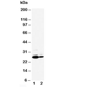 CRP / C-Reactive Protein Antibody - Western blot testing of C Reactive protein antibody and Lane 1: SMMC-7721; 2: HT1080 cell lysate