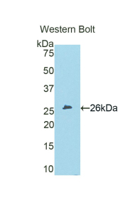 CRP / C-Reactive Protein Antibody - Western blot of recombinant CRP / C-Reactive Protein.  This image was taken for the unconjugated form of this product. Other forms have not been tested.