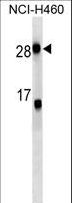CRP / C-Reactive Protein Antibody - CRP Antibody western blot of NCI-H460 cell line lysates (35 ug/lane). The CRP antibody detected the CRP protein (arrow).