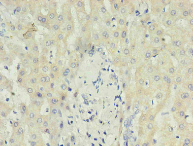 CRP / C-Reactive Protein Antibody - Immunohistochemistry of paraffin-embedded human liver using product in 30ug/ml dilute concentrations.