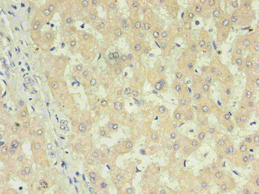 CRP / C-Reactive Protein Antibody - Immunohistochemistry of paraffin-embedded human liver using CRP Monoclonal Antibody in 30ug/ml dilute concentrations.