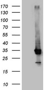 CRP / C-Reactive Protein Antibody - HEK293T cells were transfected with the pCMV6-ENTRY control. (Left lane) or pCMV6-ENTRY CRP. (Right lane) cDNA for 48 hrs and lysed. Equivalent amounts of cell lysates. (5 ug per lane) were separated by SDS-PAGE and immunoblotted with anti-CRP. (1:2000)