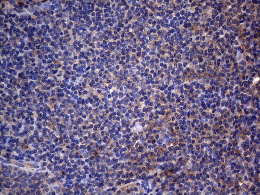 CRP / C-Reactive Protein Antibody - Immunohistochemical staining of paraffin-embedded Human tonsil within the normal limits using anti-CRP mouse monoclonal antibody. (Heat-induced epitope retrieval by 1mM EDTA in 10mM Tris buffer. (pH8.5) at 120°C for 3 min. (1:150)