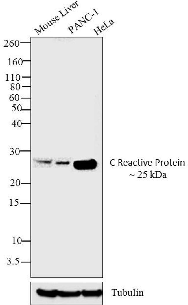 CRP / C-Reactive Protein Antibody - Western blot analysis was performed on membrane enriched extracts (30 ug) of Mouse liver (Lane 1), PANC-1 (Lane 2) and HeLa (Lane 3).The blots were probed with Anti-C Reactive Protein Mouse Monoclonal Antibody and detected by chemiluminescence using Goat anti-Mouse IgG (H+L) Superclonal Secondary Antibody, HRP conjugate. A ~25 kDa band corresponding C Reactive Protein was observed across cell lines and tissues tested. Known quantity of protein samples were electrophoresed using12 % Bis-Tris gel. Resolved proteins were then transferred onto a nitrocellulose membrane. The membrane was probed with the relevant primary and secondary Antibody using iBind Flex Western Starter Kit.