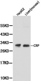 CRP / C-Reactive Protein Antibody - Western blot of CRP pAb in extracts from HepG2 cells and mouse liver tissue.