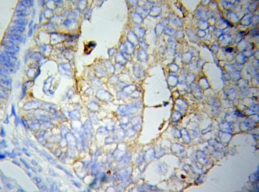 CRP / C-Reactive Protein Antibody - Immunohistochemistry (IHC) analysis of CRP pAb in paraffin-embedded human normal liver tissue.