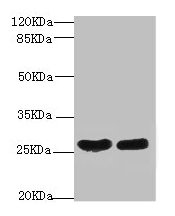 CRP / C-Reactive Protein Antibody - Western blot All lanes: C-reactive protein antibody at 2µg/ml + High values of serum Lane 1: High values of serum at 1: 5Lane 2: High values of serum at 1: 10Secondary Goat polyclonal to rabbit IgG at 1/10000 dilution Predicted band size: 26, 11 kDa Observed band size: 26 kDa