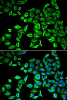 CRP / C-Reactive Protein Antibody - Immunofluorescence analysis of HeLa cells using CRP antibody. Blue: DAPI for nuclear staining.