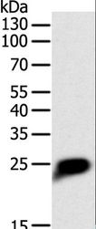 CRP / C-Reactive Protein Antibody - Western blot analysis of Human liver cancer tissue, using CRP Polyclonal Antibody at dilution of 1:1400.