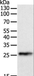 CRP / C-Reactive Protein Antibody - Western blot analysis of Human liver cancer tissue, using CRP Polyclonal Antibody at dilution of 1:800.