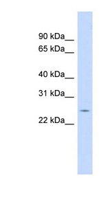 CRP / C-Reactive Protein Antibody - CRP / C Reactive Protein antibody Western blot of Placenta lysate. This image was taken for the unconjugated form of this product. Other forms have not been tested.