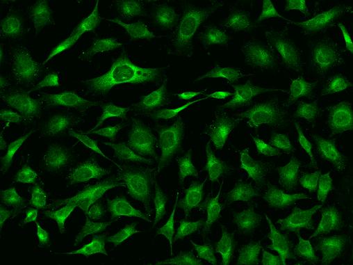 CRP / C-Reactive Protein Antibody - Immunofluorescence staining of CRP in Hela cells. Cells were fixed with 4% PFA, permeabilzed with 0.1% Triton X-100 in PBS, blocked with 10% serum, and incubated with rabbit anti-Human CRP polyclonal antibody (dilution ratio 1:200) at 4°C overnight. Then cells were stained with the Alexa Fluor 488-conjugated Goat Anti-rabbit IgG secondary antibody (green). Positive staining was localized to Cytoplasm.