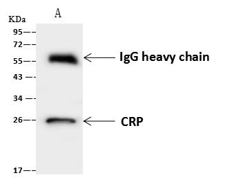 CRP / C-Reactive Protein Antibody - CRP was immunoprecipitated using: Lane A: 0.5 mg HepG2 Whole Cell Lysate. 4 uL anti-CRP rabbit polyclonal antibody and 60 ug of Immunomagnetic beads Protein A/G. Primary antibody: Anti-CRP rabbit polyclonal antibody, at 1:100 dilution. Secondary antibody: Goat Anti-Rabbit IgG (H+L)/HRP at 1/10000 dilution. Developed using the ECL technique. Performed under reducing conditions. Predicted band size: 25 kDa. Observed band size: 26 kDa.