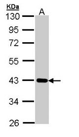 CRTAP Antibody - Sample (30 ug of whole cell lysate). A: A431 . 10% SDS PAGE. CASP / CRTAP antibody diluted at 1:1000