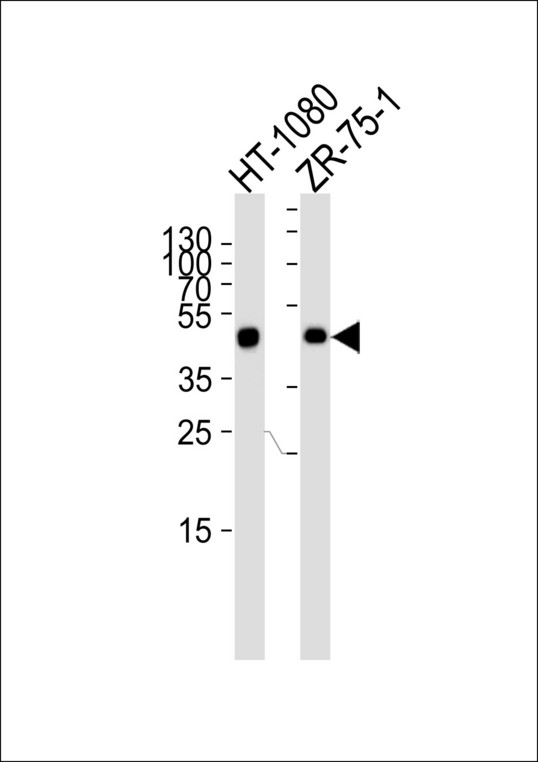 CRTAP Antibody - Western blot of lysates from HT-1080, ZR-75-1 cell line (from left to right), using CRTAP Antibody. Antibody was diluted at 1:1000 at each lane. A goat anti-rabbit IgG H&L (HRP) at 1:5000 dilution was used as the secondary antibody. Lysates at 35ug per lane.