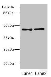 CRTAP Antibody - Western blot All Lanes: CRTAP antibody at 0.96ug/ml Lane 1: 293T whole cell lysate Lane 2: Hela whole cell lysate Goat polyclonal to Rabbit IgG at 1/10000 dilution Predicted band size: 47 kDa Observed band size: 47 kDa