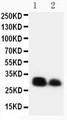 CRTC1 / MECT1 / TORC1 Antibody - WB of CRTC1 / MECT1 / TORC1 antibody. Recombinant Protein Detection Source:. E.coli derived -recombinant Human CRTC1, 29.5KD. (162aa tag+ L460-Y568). . Lane1: Recombinant Human CRTC1 Protein 10ng. Lane2: Recombinant Human CRTC1 Protein 5ng. Lane3: Recombinant Human CRTC1 Protein 2.5ng..