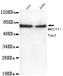 CRTC1 / MECT1 / TORC1 Antibody - Western blot detection of MECT1 / Torc1 in HeLa and Jurkat lysates using MECT1 / Torc1 mouse monoclonal antibody (1:1000 dilution). Predicted band size: 78KDa. Observed band size: 78KDa.