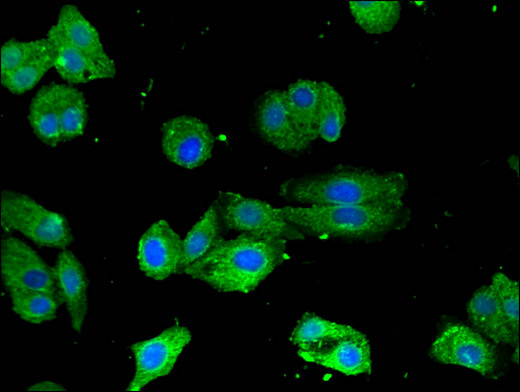 CRTC1 / MECT1 / TORC1 Antibody - Immunofluorescent analysis of HepG2 cells using CRTC1 Antibody at a dilution of 1:100 and Alexa Fluor 488-congugated AffiniPure Goat Anti-Rabbit IgG(H+L)