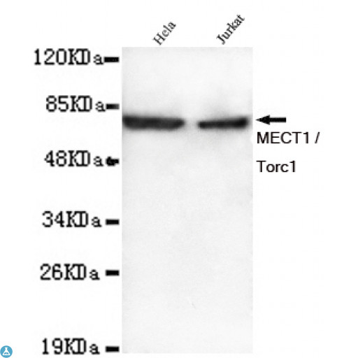 CRTC1 / MECT1 / TORC1 Antibody - Western blot detection of MECT1 / Torc1 in Hela and Jurkat lysates using MECT1 / Torc1 mouse mAb (1:1000 diluted). Predicted band size: 78KDa. Observed band size: 78KDa.