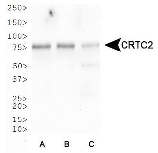 CRTC2 / TORC2 Antibody - Western Blot: Torc2 Antibody - Western blot analysis of Torc2 in A. Raji, B. Hek293 and C. Jurkat cell lysates.