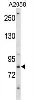 CRTC2 / TORC2 Antibody - CRTC2 Antibody western blot of A2058 cell line lysates (35 ug/lane). The CRTC2 antibody detected the CRTC2 protein (arrow).